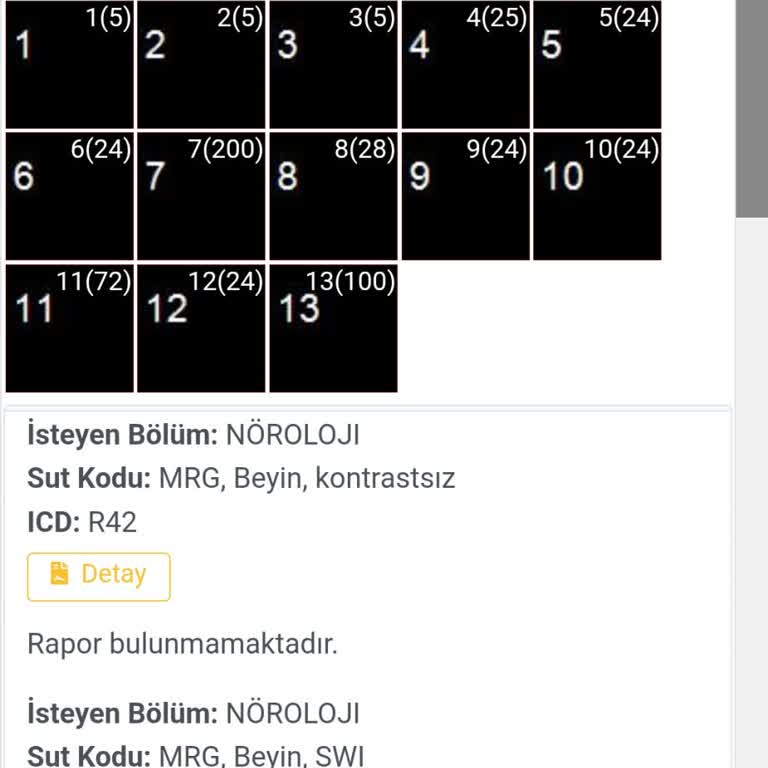 MR Sonuçlarının Gecikmesi Sağlık Sorunlarımı Artırıyor