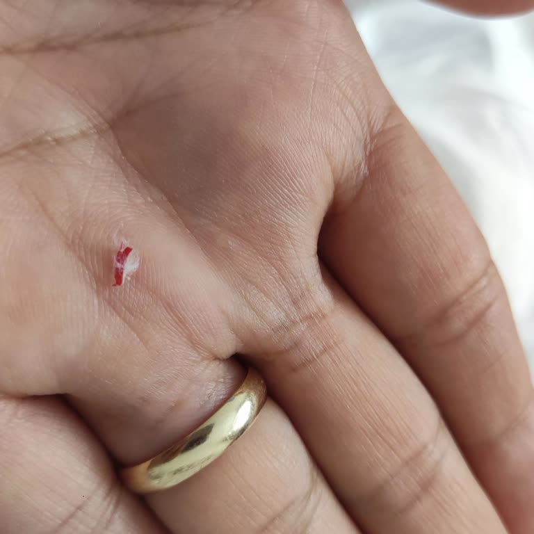 Molfix Bebek Bezinde Plastik Parça Bulunması