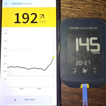 Libre Freestyle 2 Sensör Verilerinde Ciddi Tutarsızlık Ve Güven Sorunu
