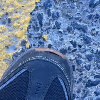 Skechers Ayakkabıda Kısa Sürede Deformasyon Ve Yetersiz Garanti Hizmeti