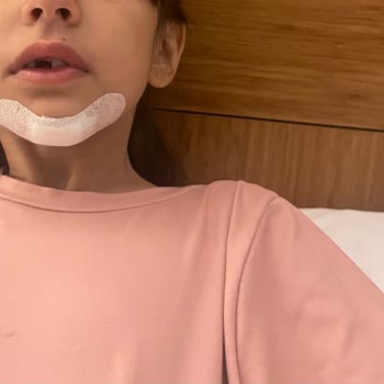 Çocuk Güvenliği İhmal Edilen Otelde Tatilimiz Acilde Geçti