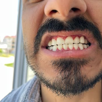 Diş Tedavisi Sonrası Sürekli Sorunlar Ve Memnuniyetsizlik