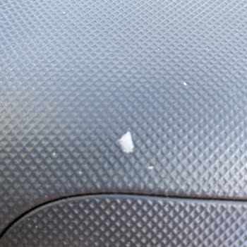 Diş Tedavisi Sonrası Sürekli Sorunlar Ve Memnuniyetsizlik