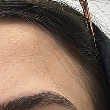 Yves Rocher Anti-Age Global Göz Kremi Alerji Yaptı, İade Talebim Var