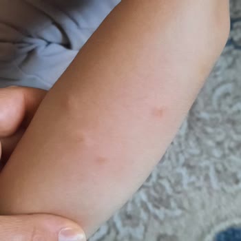 Belediyeye Ait Alanda Temizlik Eksikliği Böcek Sorununa Yol Açıyor