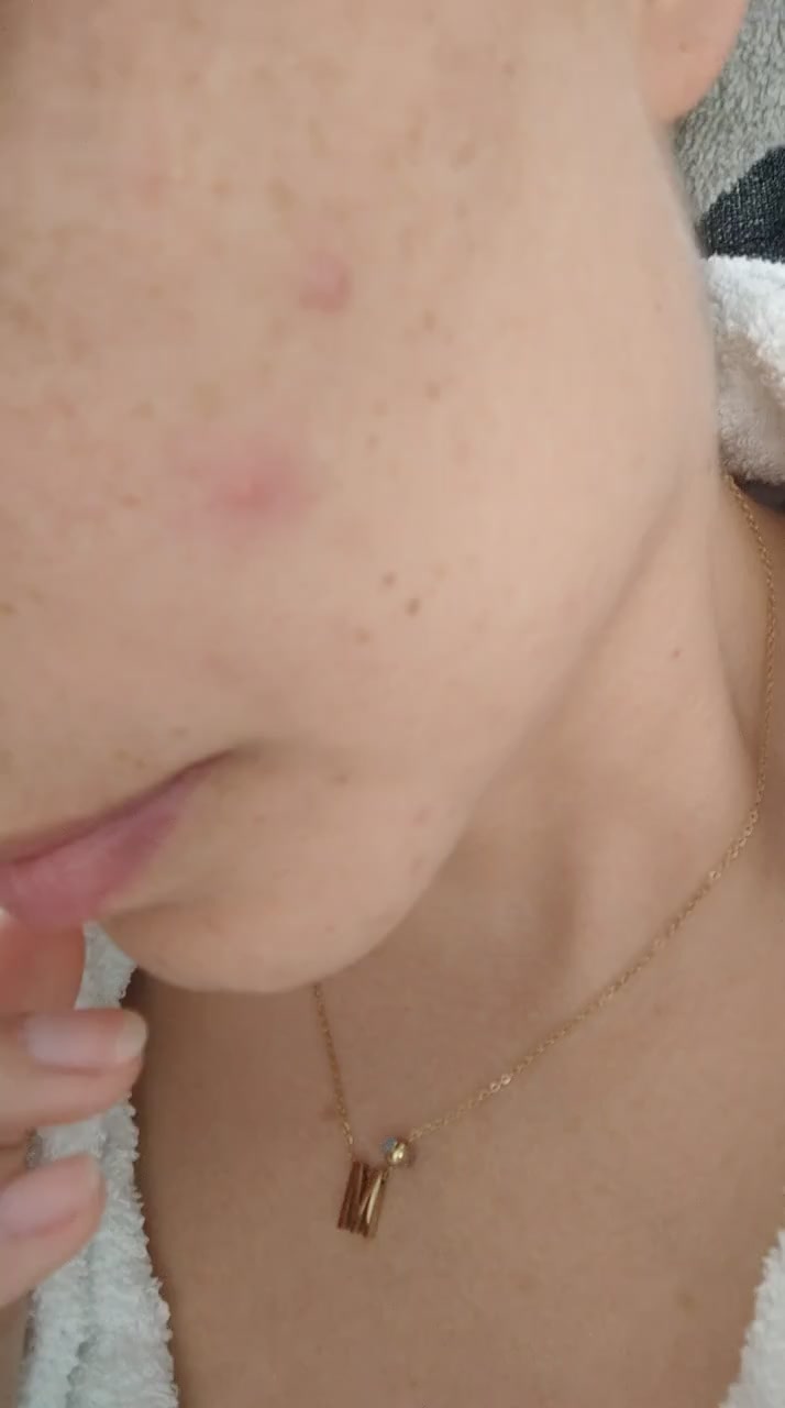 Yves Rocher Bright Botanical Face Cream Gave Me Painful, Long-Lasting Acne video cover