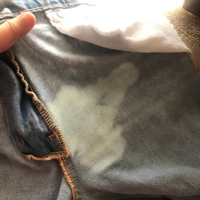 Erciyes Üniversitesi Diş Hekimliği Fakültesi Tedavi Sırasında Pantolonuma Hipo Döküldü