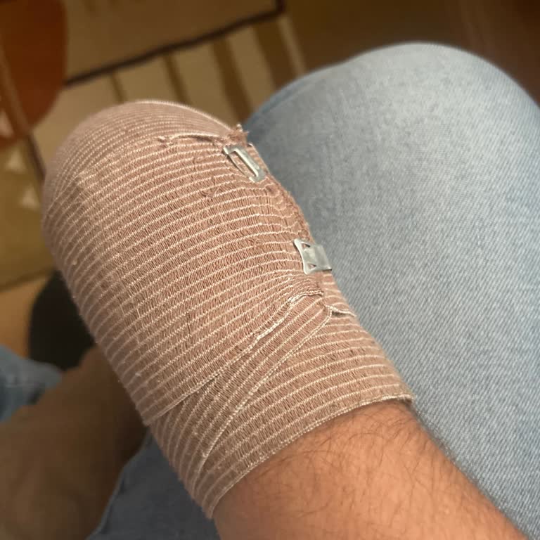Anadolu Sigorta Engelli Tazminatım Yıllardır Ödenmiyor, Mağduriyetim Artıyor