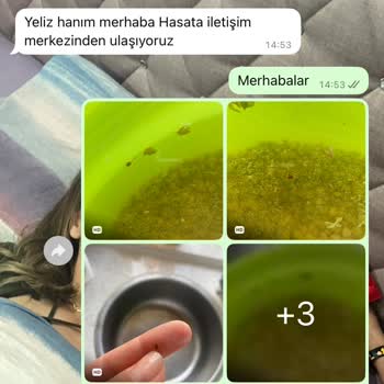 Yeşil Mercimekte Böcek Çıktı Müşteri Hizmetleri İlgilenmedi