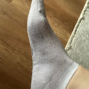 Skechers Ayakkabıdan Siyah Boya Akması ve Ürün Kalitesinde Sorun