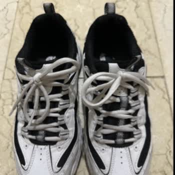 Skechers Ayakkabıdan Siyah Boya Akması ve Ürün Kalitesinde Sorun