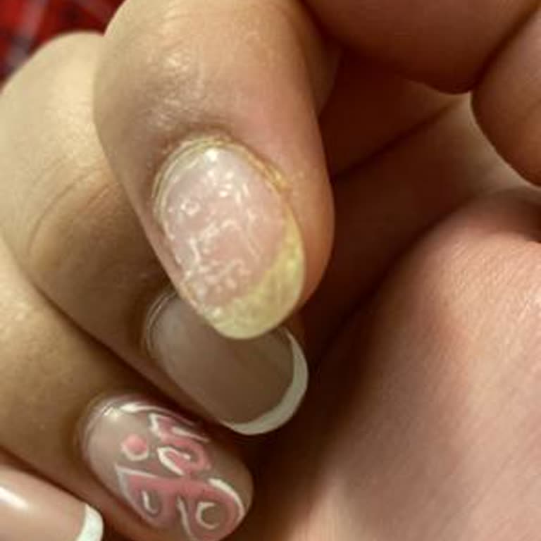 Kalıcı Oje Ve Jel Güçlendirme Sonrası Kısa Sürede Çıkan Ojeler