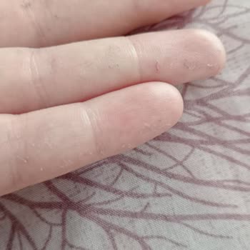 Neutrogena Kremde İki Kez Bozuk Kıvam Sorunu Yaşadım, Çözüm Bekliyorum