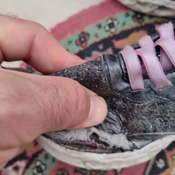 Skechers Çocuk Ayakkabısı Kısa Sürede Bozuldu, Firma Sorumluluk Almıyor