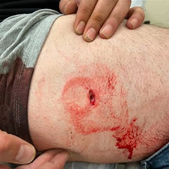 Martı Şiddet Mağduru Sürücünün Hesabı Haksız Yere Kısıtlandı