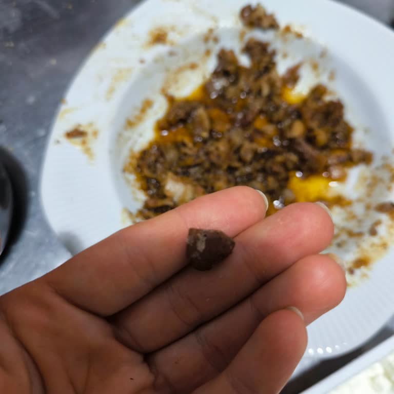 Migros'tan Alınan Kokoreçte Yabancı Madde Ve Kalite Sorunu