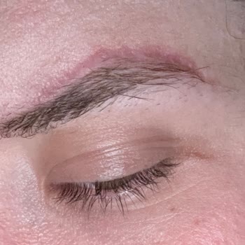 Dr. Estetik Nargiz Evinin Odasında Yaptığı İşlemle Yüzümü Mahvetti