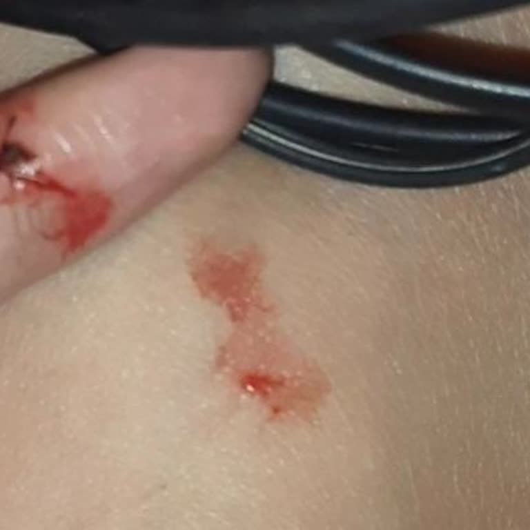 Ex Kov İşe Yaramıyor!