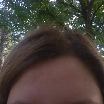 Aldığım Akne Kremi Ve Serumu Yüzümde Alerji Yaptı, İade Sorunu Yaşıyorum