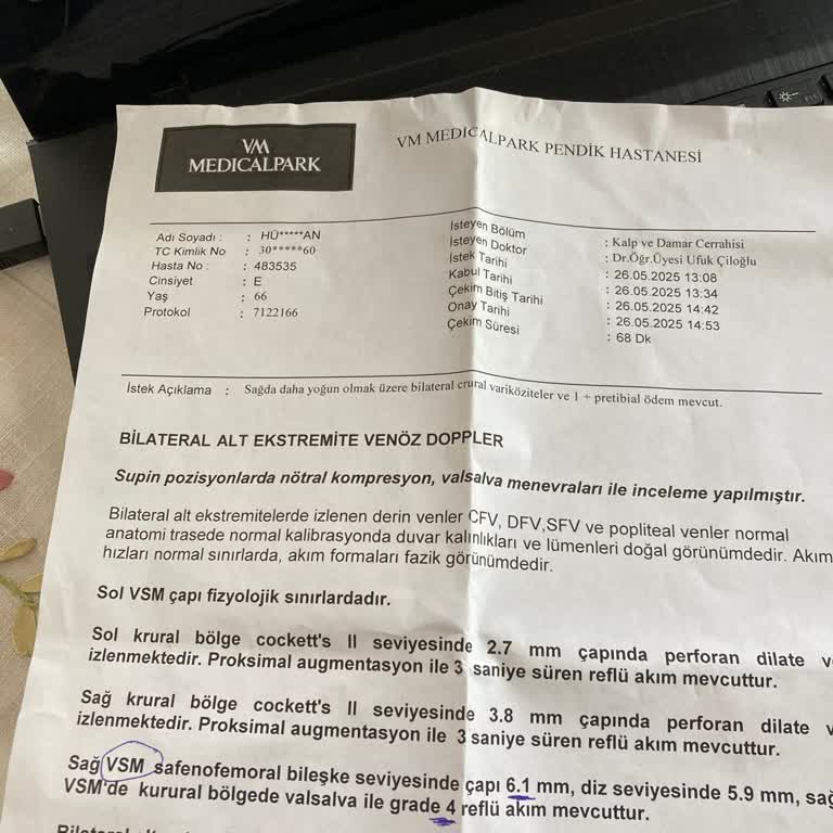 Dobler İşlemi İçin Yüksek Fark Ücreti Talebi