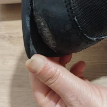 Slazenger Spor Ayakkabının Kısa Sürede Deforme Olması