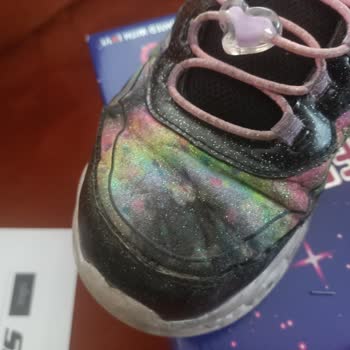 Bir Ayda Yıpranan Skechers Ayakkabıya Ret Cevabı Şoku