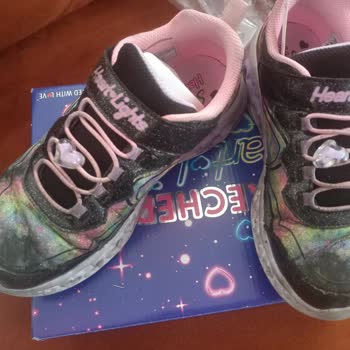 Bir Ayda Yıpranan Skechers Ayakkabıya Ret Cevabı Şoku