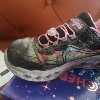 Bir Ayda Yıpranan Skechers Ayakkabıya Ret Cevabı Şoku