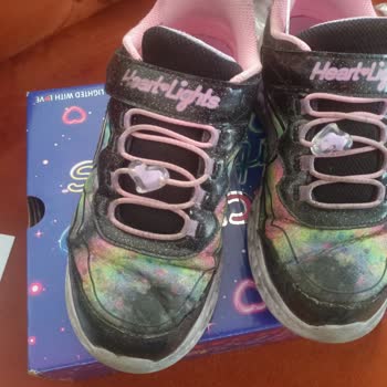 Bir Ayda Yıpranan Skechers Ayakkabıya Ret Cevabı Şoku