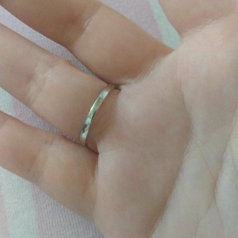 Altınbaş Yüzükte Eklenen Parça Karardı, Hatalı İşlem İçin Uzun Bekleme