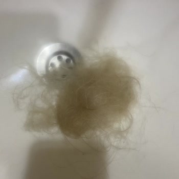 Aldığım Perukta Sürekli Dökülme Ve Kalite Sorunu