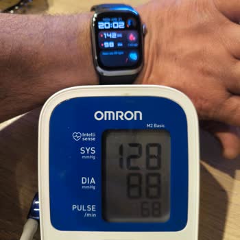 Huawei Watch D2 Tansiyon Ölçümünde Tutarsızlık Ve İade Sorunu