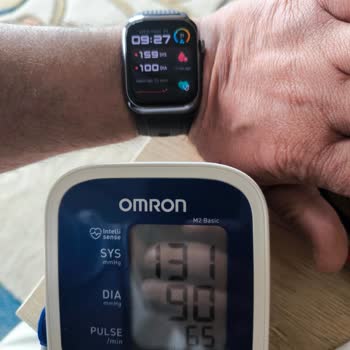 Huawei Watch D2 Tansiyon Ölçümünde Tutarsızlık Ve İade Sorunu