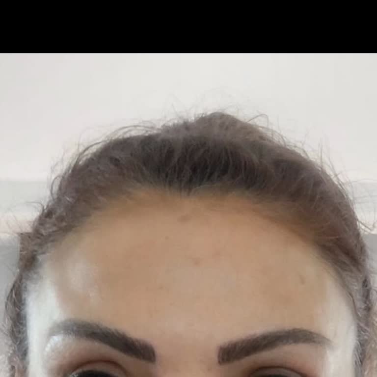Bahar Babacan Beauty Center Güzellik Merkezinde Kaş Simetrisi Sorunu Ve Güven Problemi