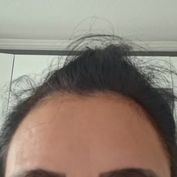 Kaş Microblading İşleminde Büyük Hayal Kırıklığı Ve İlgisizlik