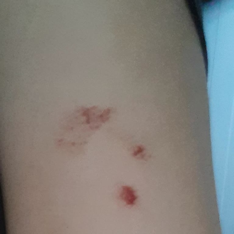 Epify Tüy Dökücü Krem Hem Etkisiz Hem Zararlı