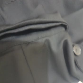 Kusurlu Elbise İçin Para İadesi Talebim Reddedildi Mağduriyetim Giderilsin