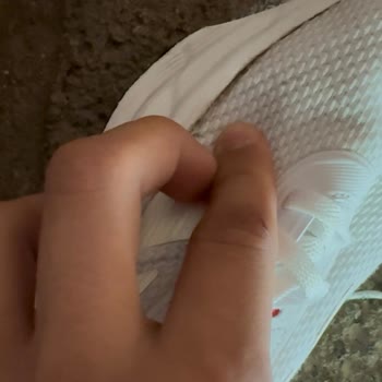 Satın Aldığım Ayakkabıda Filede Sorun Ve Yetersiz İnceleme Süreci