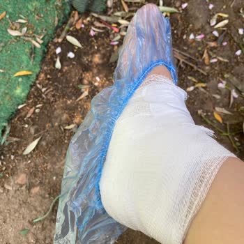 Otobüste Sıcak Su Kazası: Yolcu Güvenliği Tehlikede!