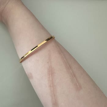 Medical Clinic | Diyarbakır Kolumda Lekeler Kaldı!