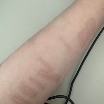 Medical Clinic | Diyarbakır Kolumda Lekeler Kaldı!