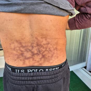 Op. Dr. Fatih Kırar Tedavi Sonrası İlgisizlik Ve Belgelerle İlgili Mağduriyet