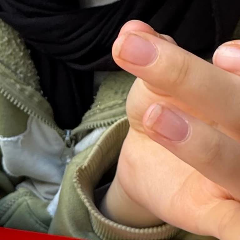 Yemekte Hijyen Sorunu Ve İlgisiz Personel Nedeniyle Olumsuz Deneyim