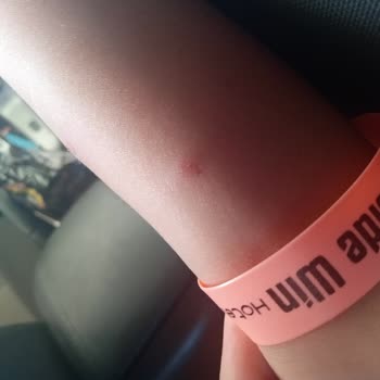 Kötü Temizlik Ve Sağlıksız Koşullar Nedeniyle Yarıda Kalan Tatil