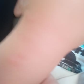 Kötü Temizlik Ve Sağlıksız Koşullar Nedeniyle Yarıda Kalan Tatil