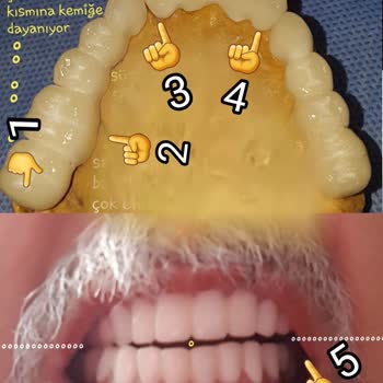 Dentanorm Diş Tedavisinde Hatalı İşlem Ve Mağduriyet