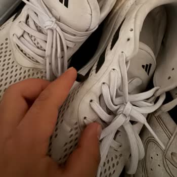 Adidas Supernova 2.0 Ayakkabıda Logo Soyulması Ve Astar Yırtılması