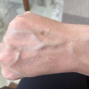 I Got New Dark Spots After Using Nivea Anti-Dark Spot Serum and Creams