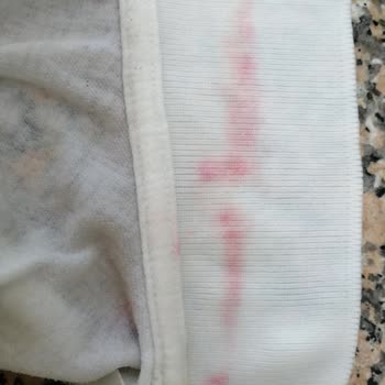 Domestos Çamaşır Suyu Kullandığım Kıyafette Renk Değişikliğine Sebep Oldu