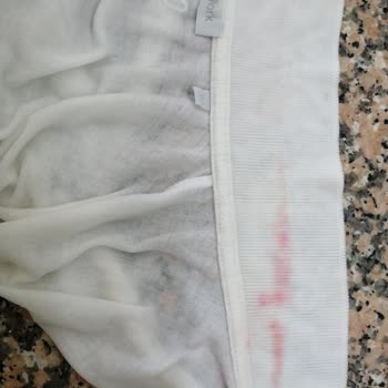 Domestos Çamaşır Suyu Kullandığım Kıyafette Renk Değişikliğine Sebep Oldu